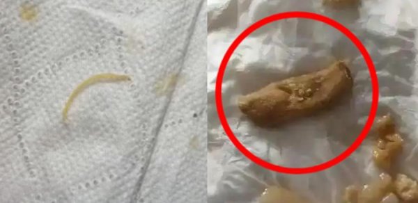 日斗配资 恶心到想吐！热销品牌吃出脚趾甲、烟头？曾排销量榜第一，客服回应